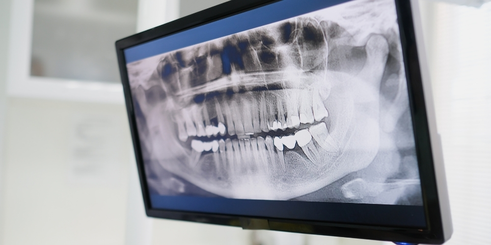 Treatment Of Facial Injuries fort worth tx
