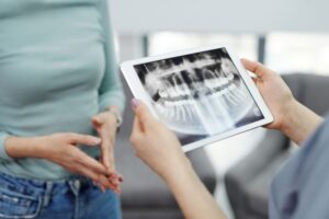 dentist reviewing xrays with woman patient