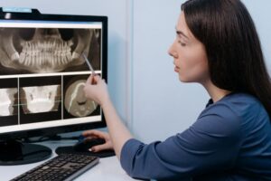 Dental professional woman reviewing wisdom teeth xray